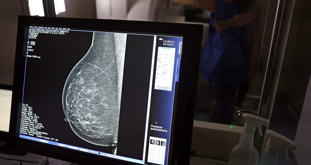 Carreta oferece mamografias gratuitas na BA; veja como agendar | G1
