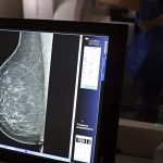 Carreta oferece mamografias gratuitas na BA; veja como agendar | G1