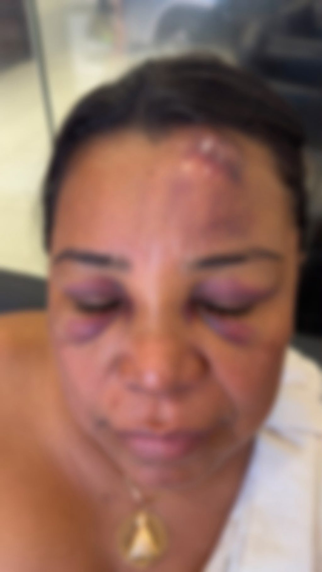 Mulher denuncia agressão de PMs no São João de Maceió; VÍDEO | G1