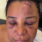 Mulher denuncia agressão de PMs no São João de Maceió; VÍDEO | G1